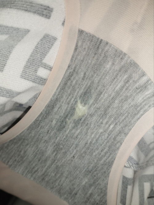 Vaginal discharge