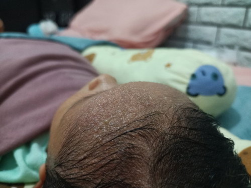 Minta saran ny dong Bun,maklum new mom