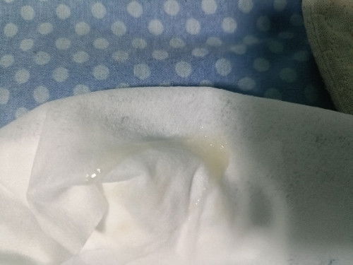 มีมูกใสควรไปโรงพยาบาลไหม