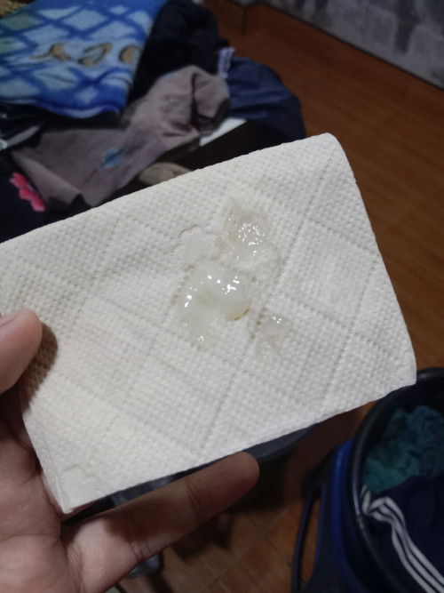 39w มีมูกใสออก ไม่ปนเลือดอันตรายมั้ยค่ะ ต้องไปโรงบาลมั้ยคะ