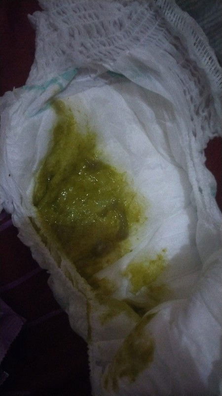 bund,bayi sy 6bln3hr Bab mencret dan berwarna hijau.sudah k igd jg. adakah bund² pernah spt sy