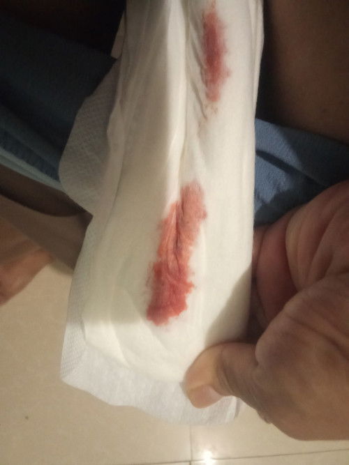 sinong momshies na nakaranas nang spotting na parang menstruation, pero 3 months nang preggy?..