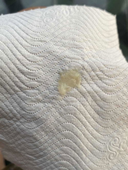 แบบนี้เรียกมูกหรือตกขาวคะ