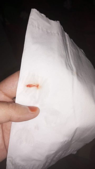 Bunda, disini ada ga yg pipis tbtb keluar lendir kaya gitu dikit. 
Gada rasa apa" juga?