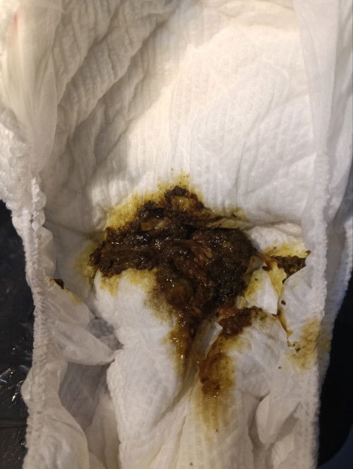 Adakah Normal?