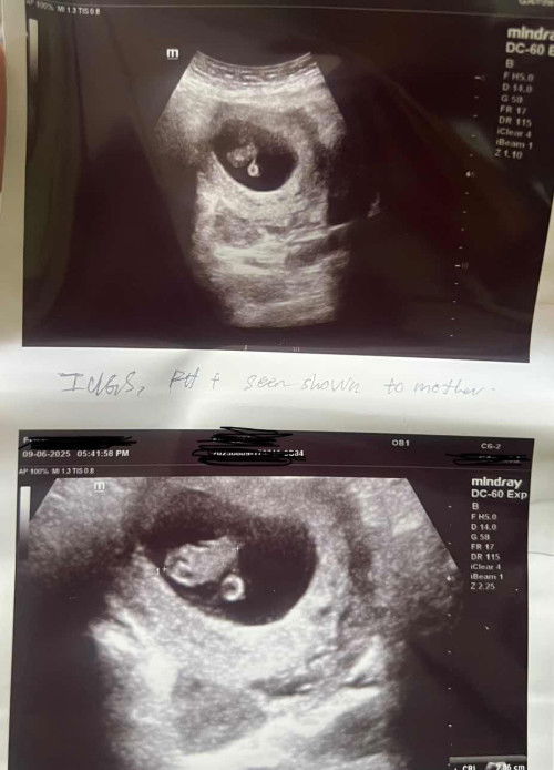 Baby twin ke tak ya ?