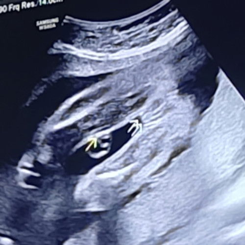 Gender Scan