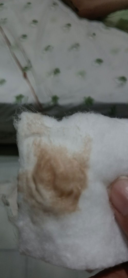 Ada yg prnah ngalamin di siklus 23 tiba² ngeflek kaya gini