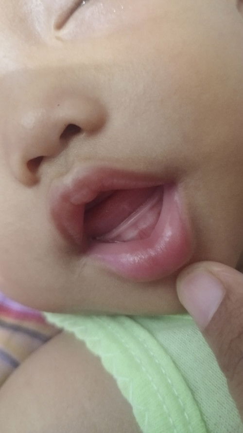Ciri gigi bayi tumbuh
