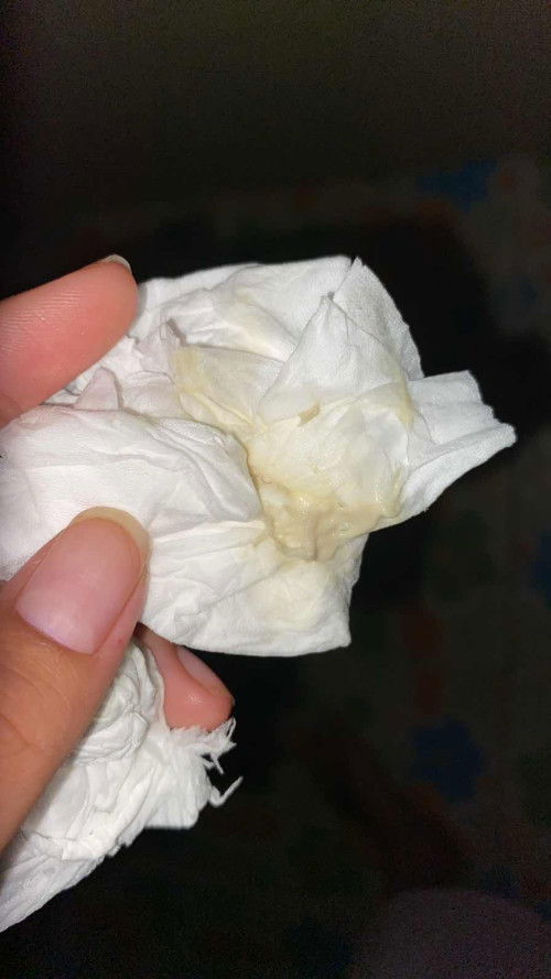 แบบนี้คือตกขาวผิดปกติมั้ยคะ