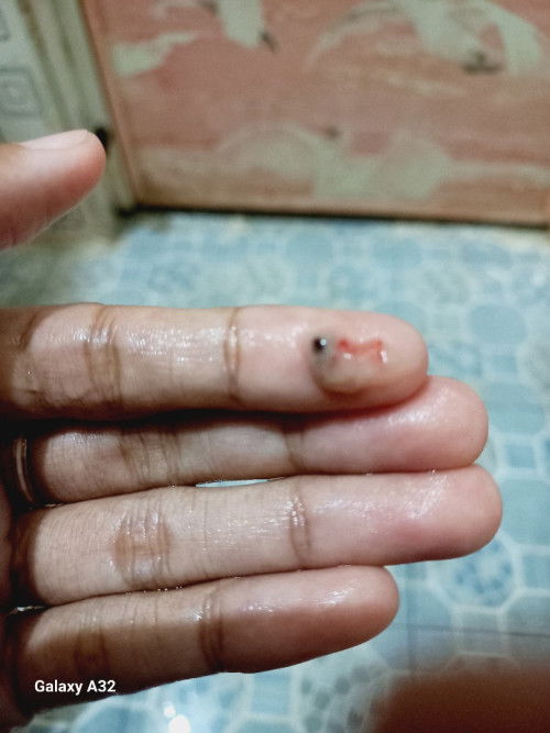 Ini apa bund? Janin bukan ya?