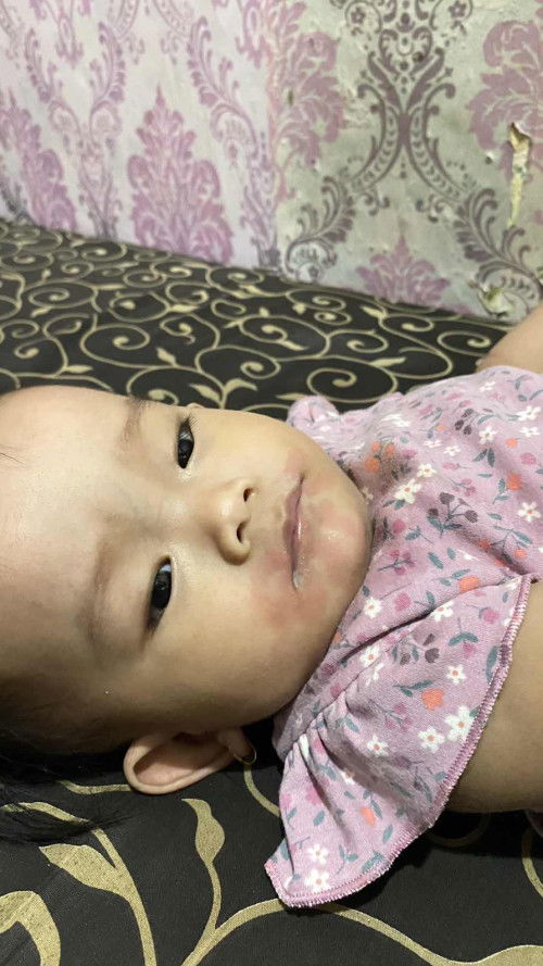 ALERGI ATAU BUKAN?