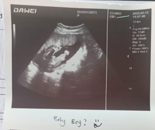 Gender anak