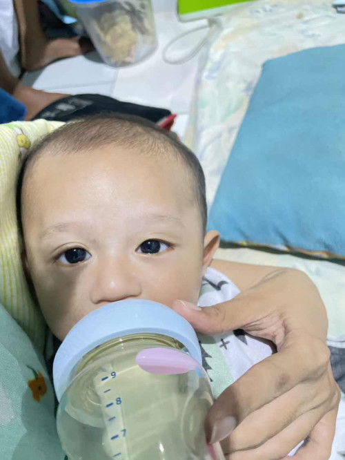 Bercak putih di wajah bayi