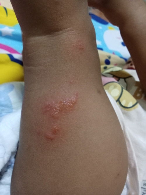 ตุ่มอะไรหรอค่ะ