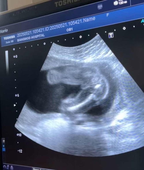 ทุกคนคิดว่าเจ้าจิ๋วจะเป็น ญ หรือ ช