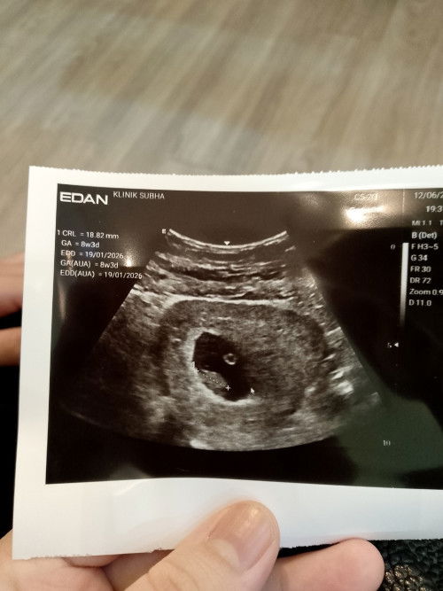 TWIN BABY TAPI X SAMA BESAR.