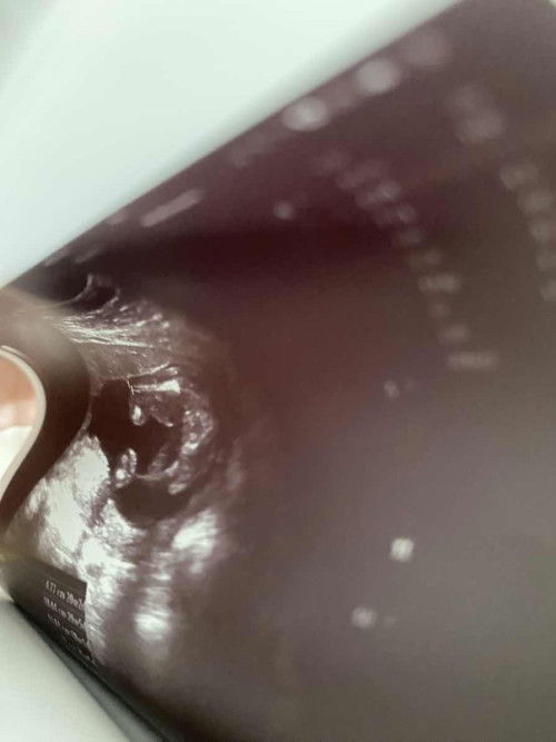 อยากรู้เพศน้องค่ะ