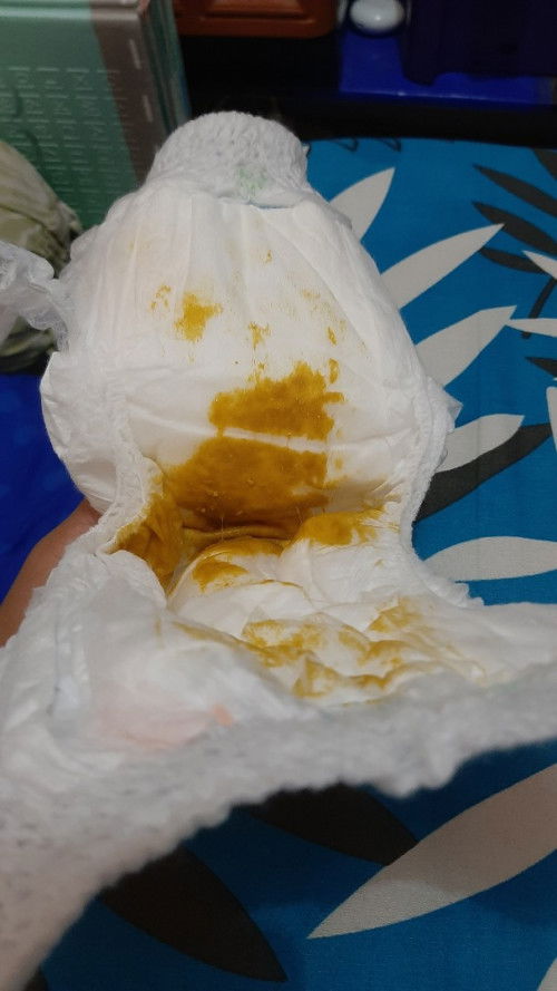 Bun klo pup kyak gini diare bukan ya?