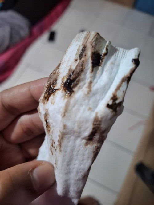 Flek cokelat di sertai sakit perut bagian bawah , sakit pinggang , sakit miss v