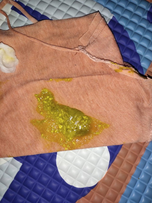 Bun. Maaf kalau jorok. Saya mau tanya. Pup bayi 4 bln bgini normal gk ya?  Apa ini brwrna hijau?