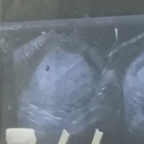 Ilang weeks bago makita si Baby? Nagpa trans V ako 5 weeks pa lang daw, Sac pa lang nakita.