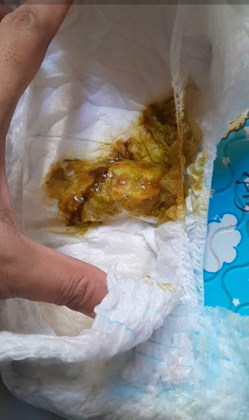 Masalah pup bayi
