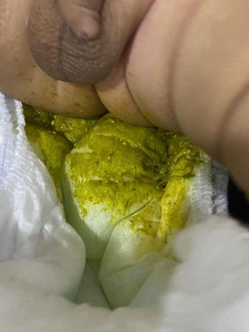 Berak hijau