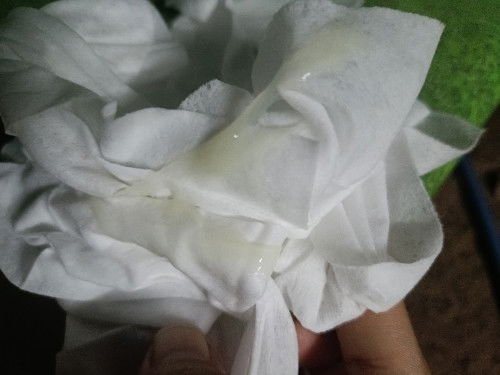 มูกใสออกจากช่องคลอด