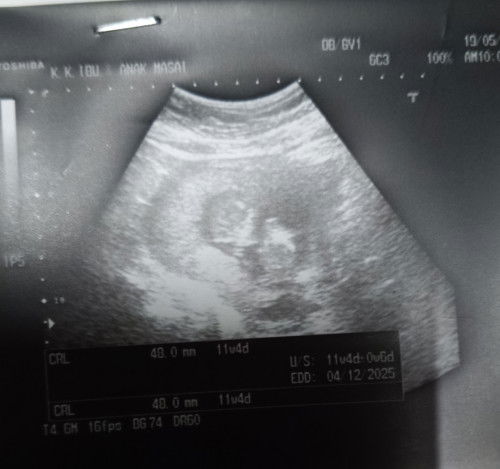 Baby girl or boy