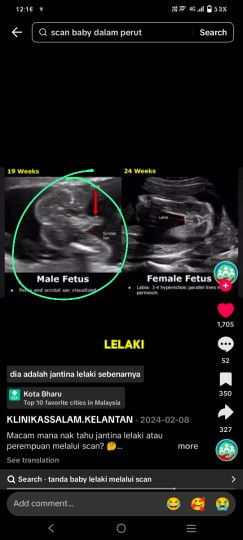 Scan baby