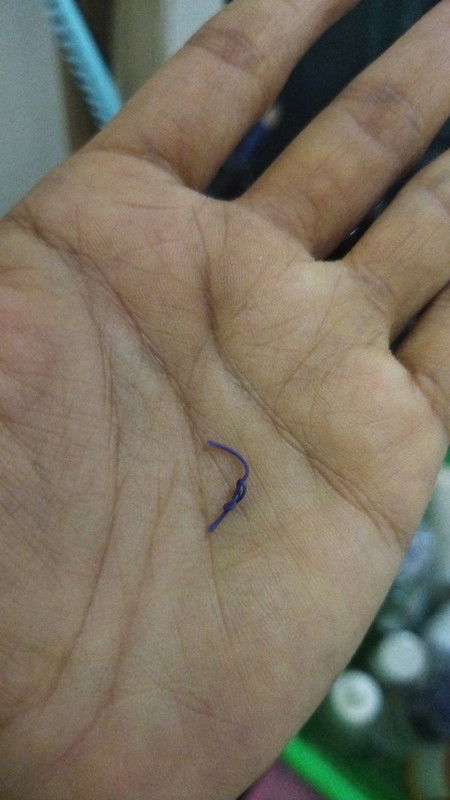 Jahitan pasca lahiran normal