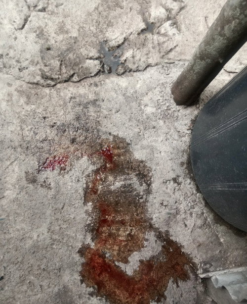 False positive,blood discharge 8 weeks pregnant