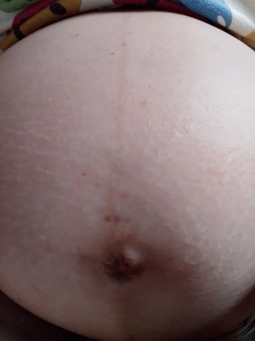 ท้องแบบนี้ผู้หญิงหรือผู้ชายค่ะ