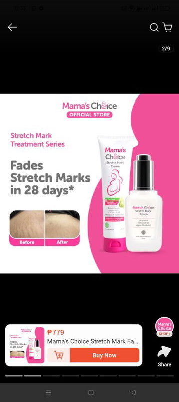 Stretch mark