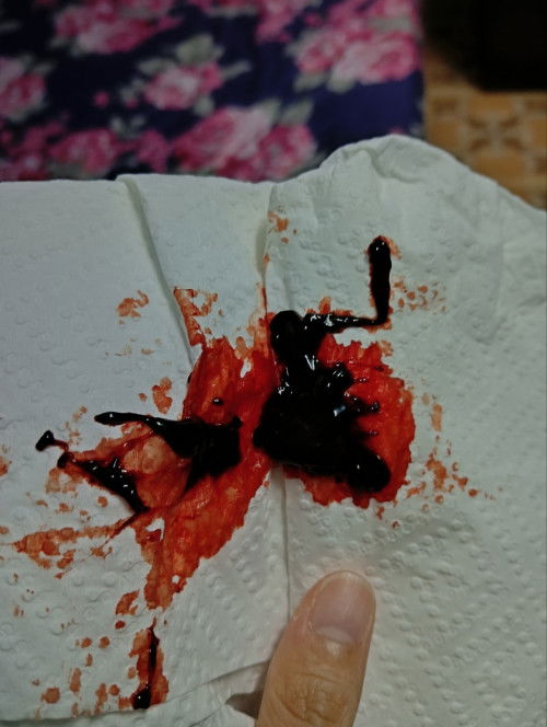 normal ke pendarahan macam ini?