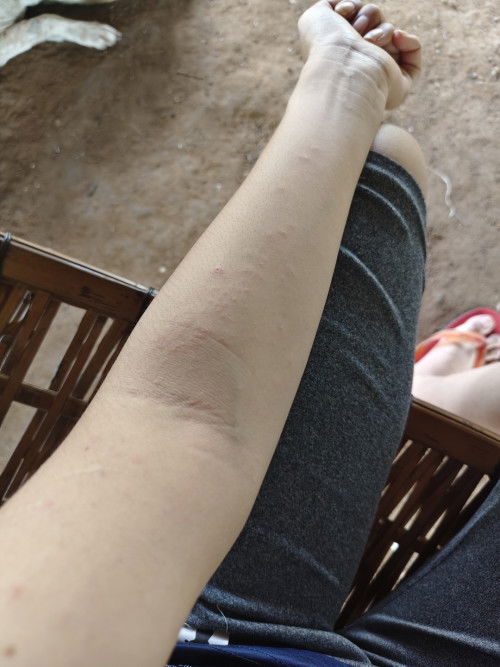 15wแม่ๆบ้านไหนมีอาการแบบเดียวกันไหมค่ะ