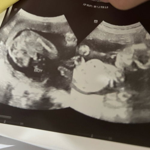 Boy po ba talaga mga mommies?