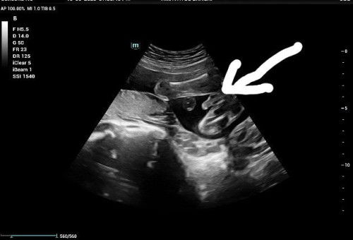 gender scan 2d