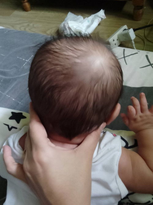 Hi mi ask ko lng kung flat head ba si baby nag woworey kasi ako Di sya Bilog Bale ung hugis nya flat