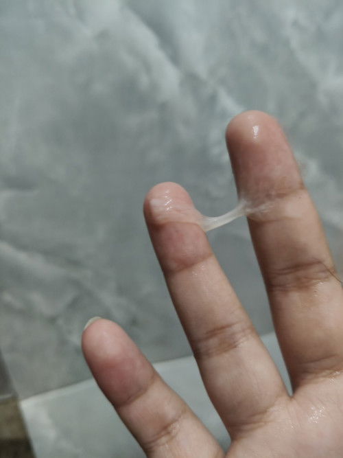 MAY GANTONG DISCHARGE NA LUMALABAS