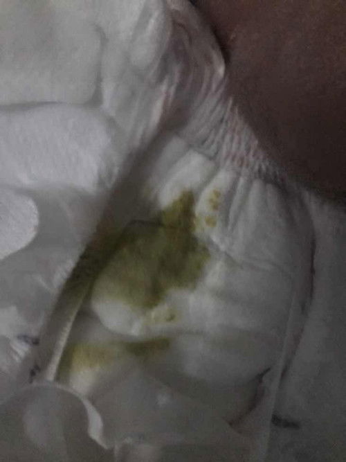 GREEN POOP