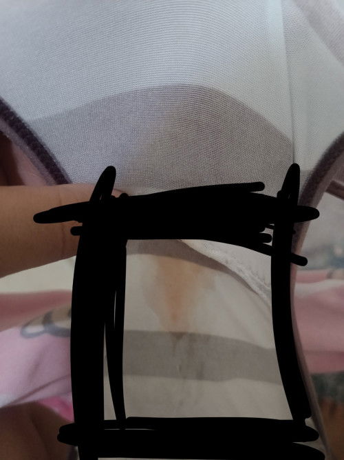 Bakit po kaya ganito discharge ko?