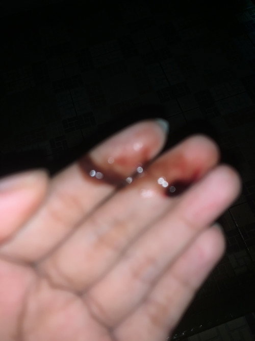 Hpl 22 Juni keluar lendir darah dan flek coklat