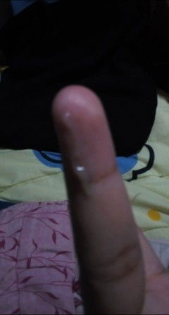 แม่ๆค่ะคือหนูมีน้ำแบบนี้ออกมาปวดท้องเป็นๆหายๆมีตกขาวไม่มีกลิ่นไม่คัน