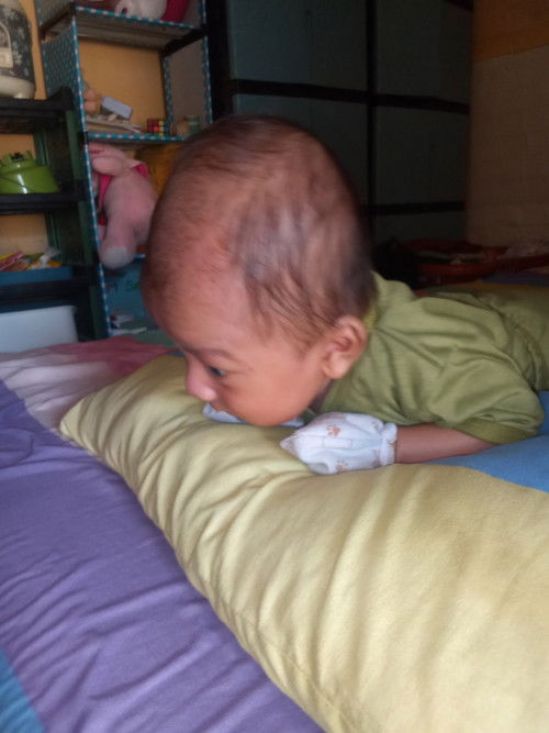Bund mau tanya normal kah kepala bayi seperti ini ?