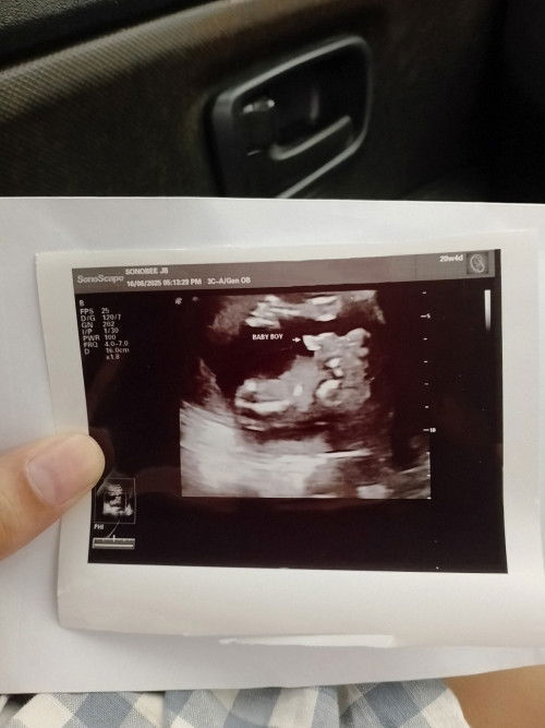 Gender boy or girl