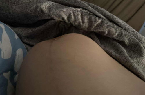 แบบนี้ท้องแข็งหรือลูกโก่งตัวคะ