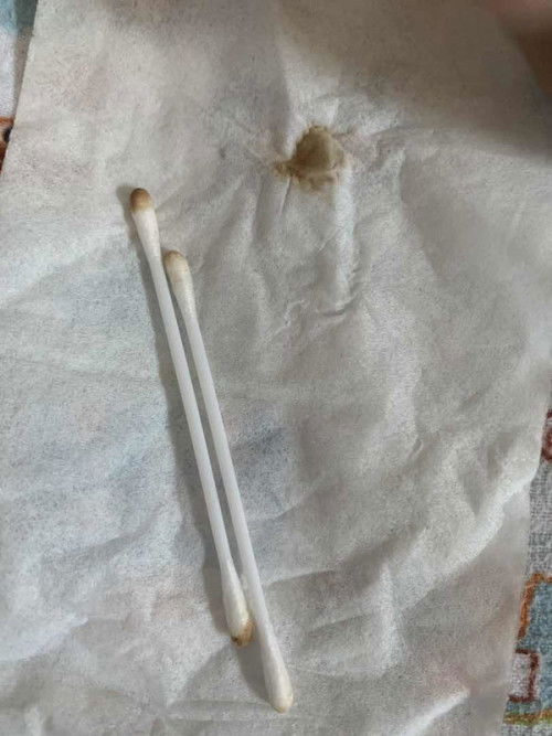 Telinga Baby Berbau