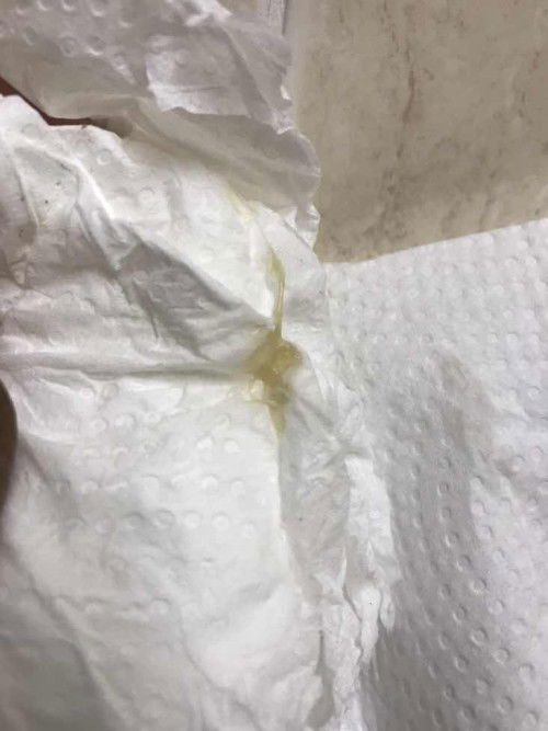 Keputihan ke ni? Saya GBS+